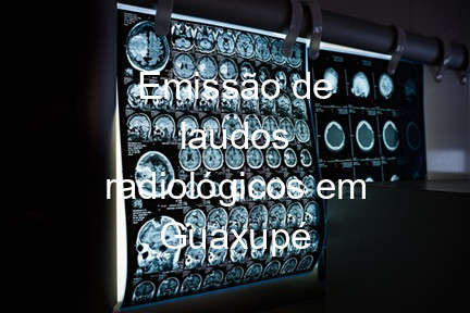 Emissão de laudos radiológicos em Guaxupé