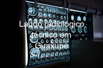 Laudo radiológico técnico em Guaxupé