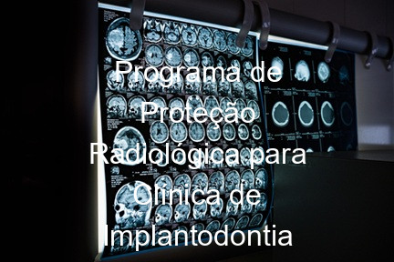 Programa de Proteção Radiológica para Clínica de Implantodontia em Poços de Caldas