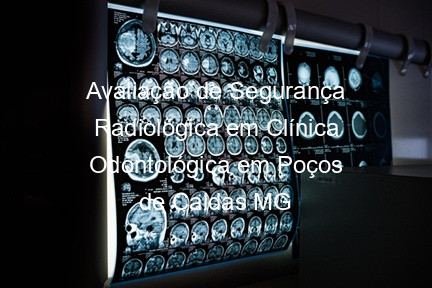 Avaliação de Segurança Radiológica em Clínica Odontológica em Poços de Caldas MG