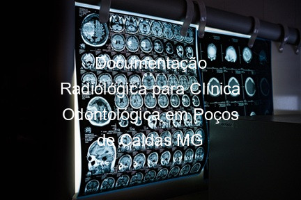 Documentação Radiológica para Clínica Odontológica em Poços de Caldas MG