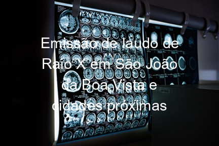 Emissão de laudo de Raio X em São João da Boa Vista e cidades próximas