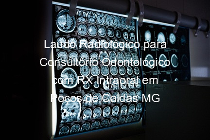 Laudo Radiológico para Consultório Odontológico com RX Intraoral em Poços de Caldas MG