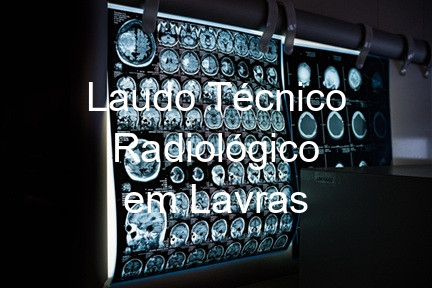 Laudo Técnico Radiológico em Lavras