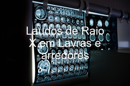 Laudos de Raio X em Lavras e arredores