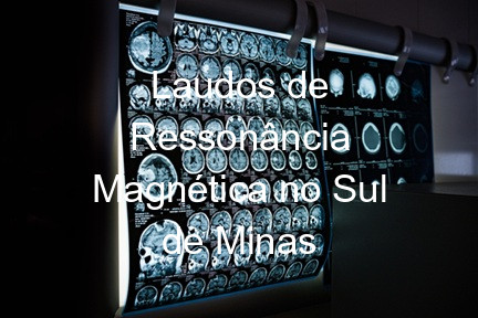 Laudos de Ressonância Magnética no Sul de Minas