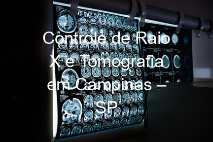 Controle de Raio X e Tomografia em Campinas – SP