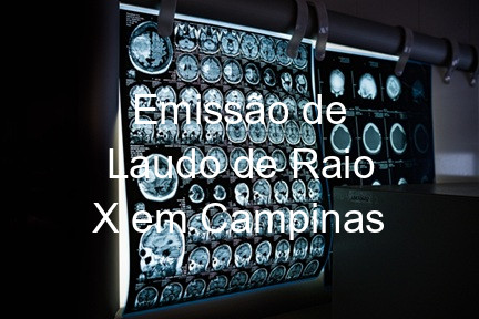 Emissão de Laudo de Raio X em Campinas